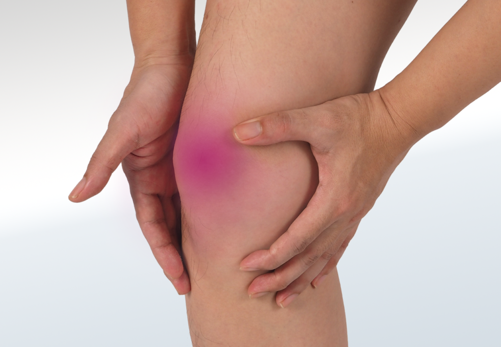 Patellofemoral Pain Syndrome