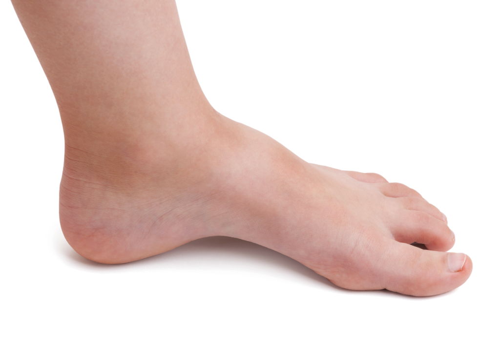 High Instep