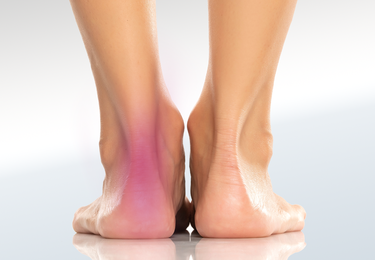 Achilles Tendinitis/Tendinosis - Relieve Foot Pain & Leg Pain