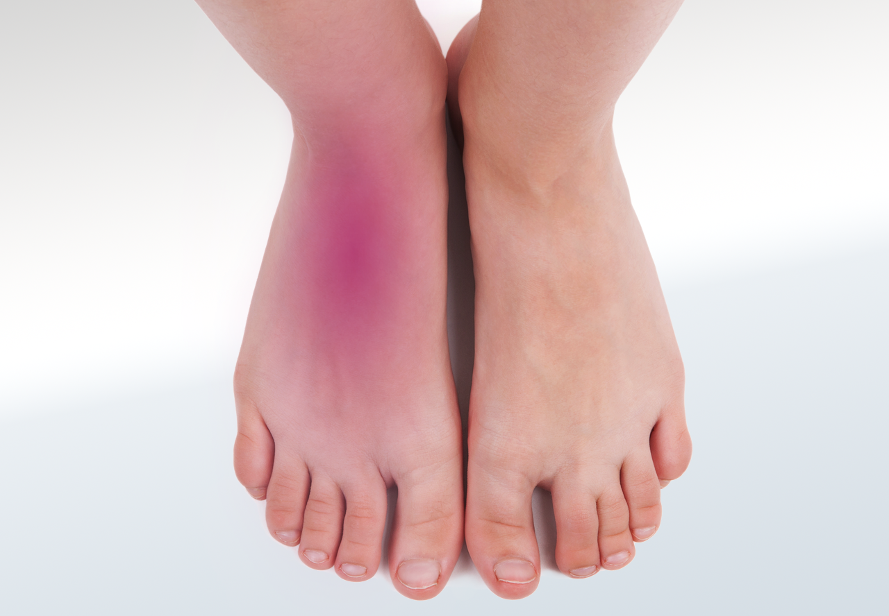 Extensor tendinitis relieve foot pain leg pain