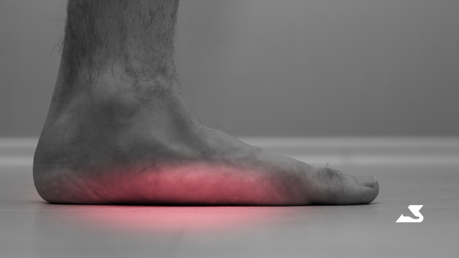 Flat Feet Could be the Cause of your Back, Hip, and knee pain