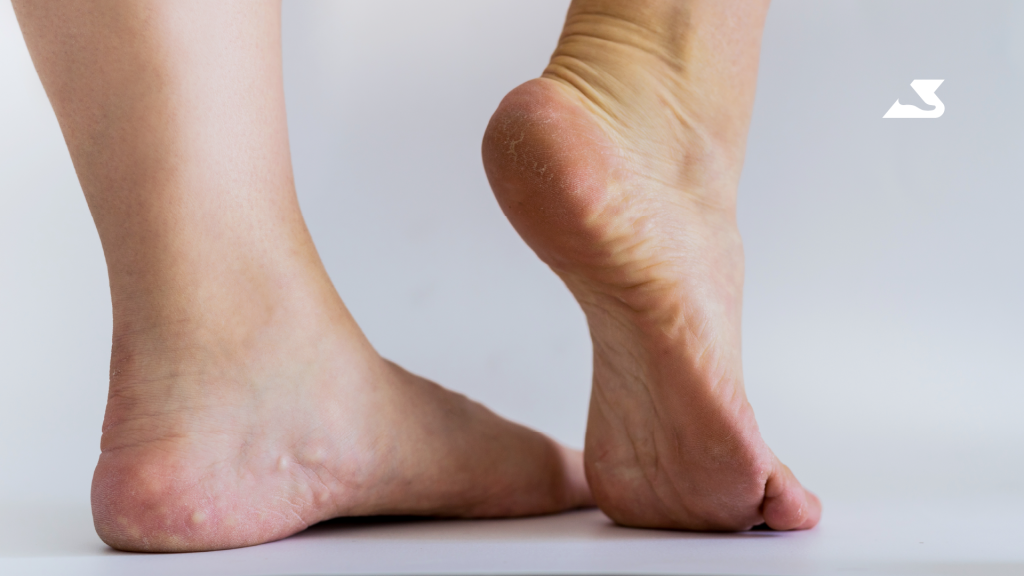 Custom Orthotics for Foot & Leg Pain BioPed Toronto