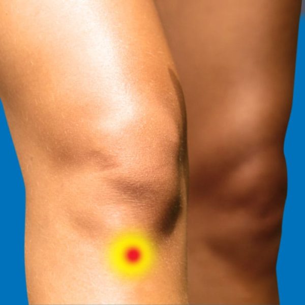 Osgood Schlatters Disease Relieve Foot Pain & Leg Pain