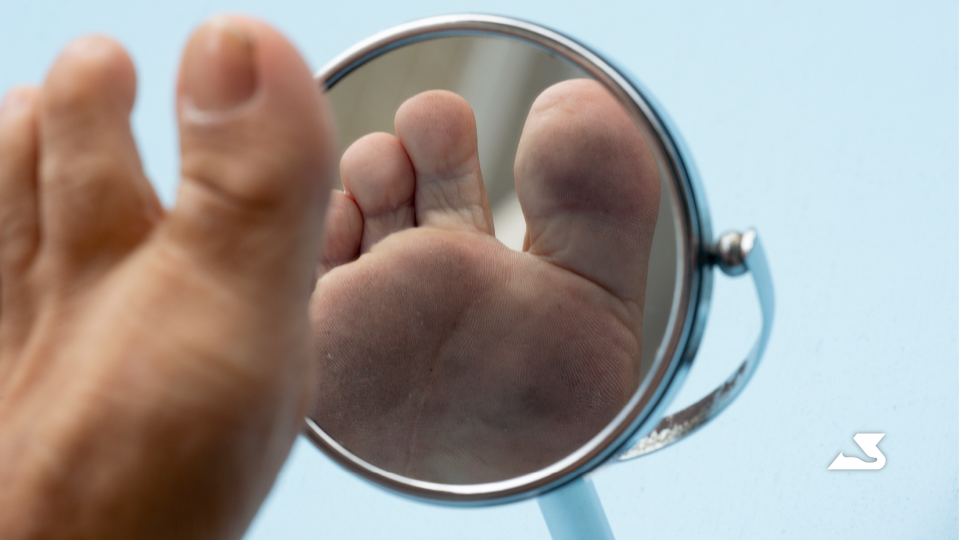 Foot blisters