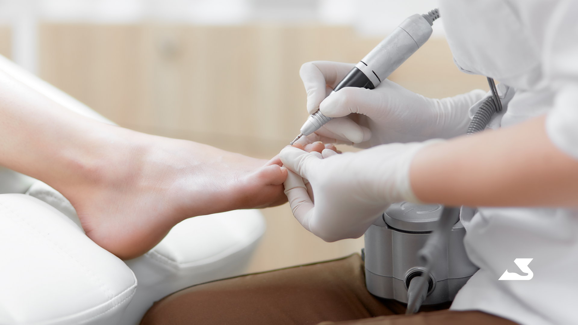 Fungal Toenails – How Do I get Rid of This?